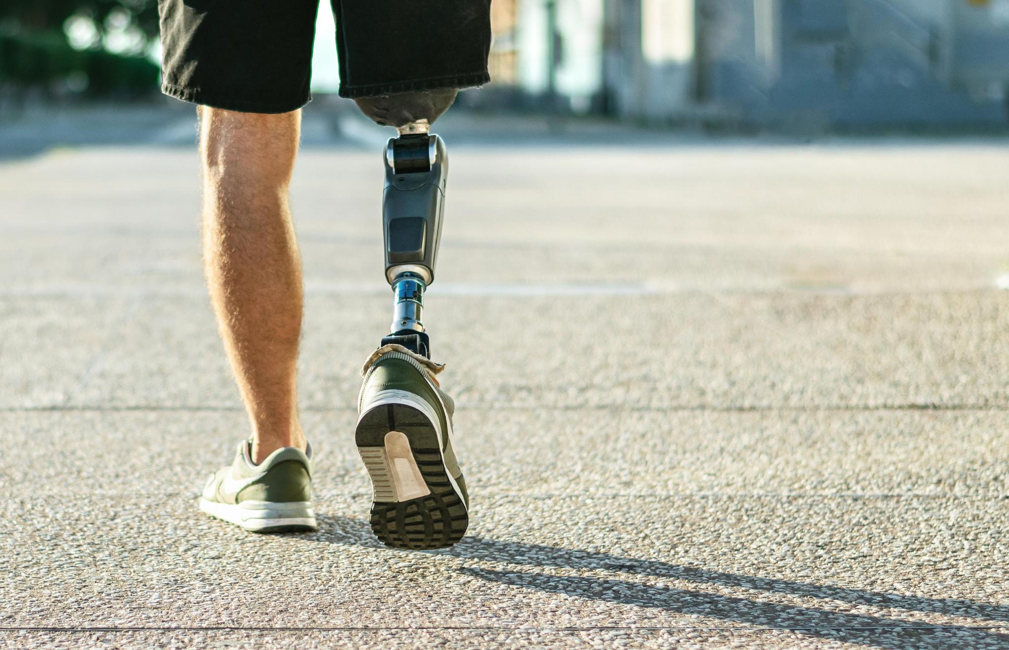 A person walking, wearing shorts, with a below-the-knee robotic prosthetic leg
