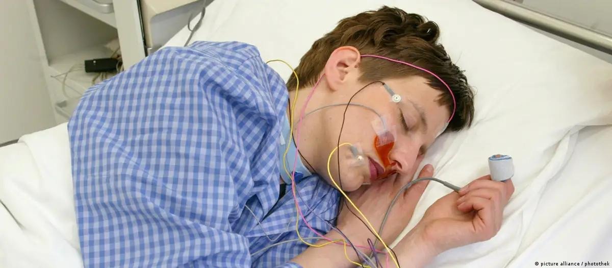A young man asleep in a hospital bed, wired up with sleep-study electrodes on his face and scalp and a pulse oximeter on his finger